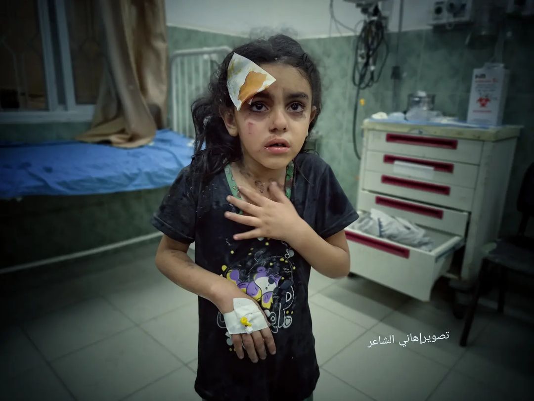 injured child gaza