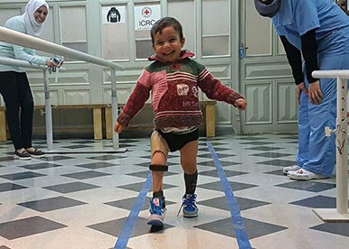 child with prosthetic limbs